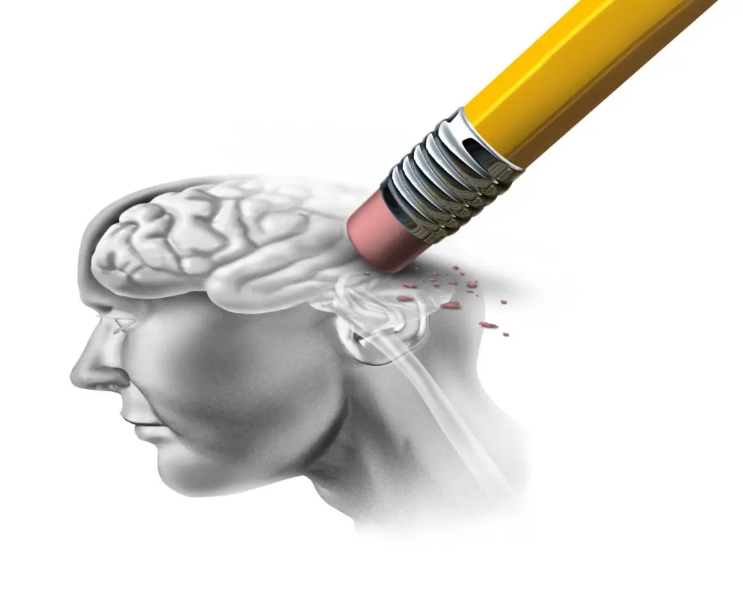 Conceptual illustration of memory loss in Alzheimer's disease