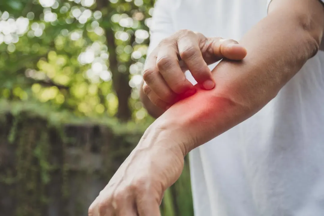 Persistent nerve pain after shingles can disrupt sleep and daily activities